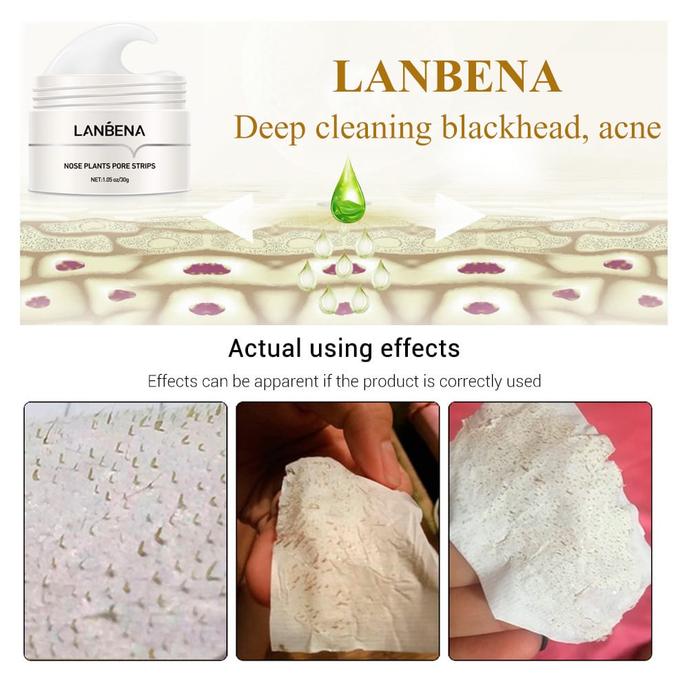 LanBena - Blackhead Nasal Membrane Remover - Image 10